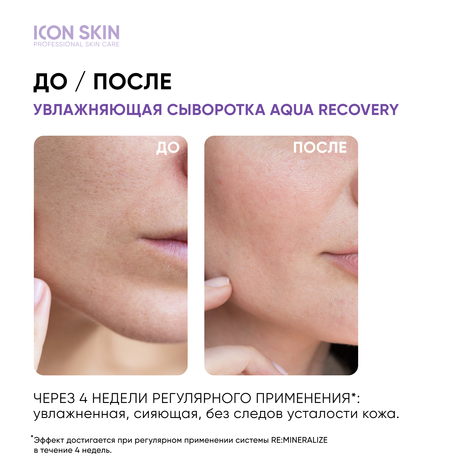 Сыворотка ICON SKIN увлажняющая с гиалуроновой кислотой и минералами aqua recovery 30 мл - фото 2