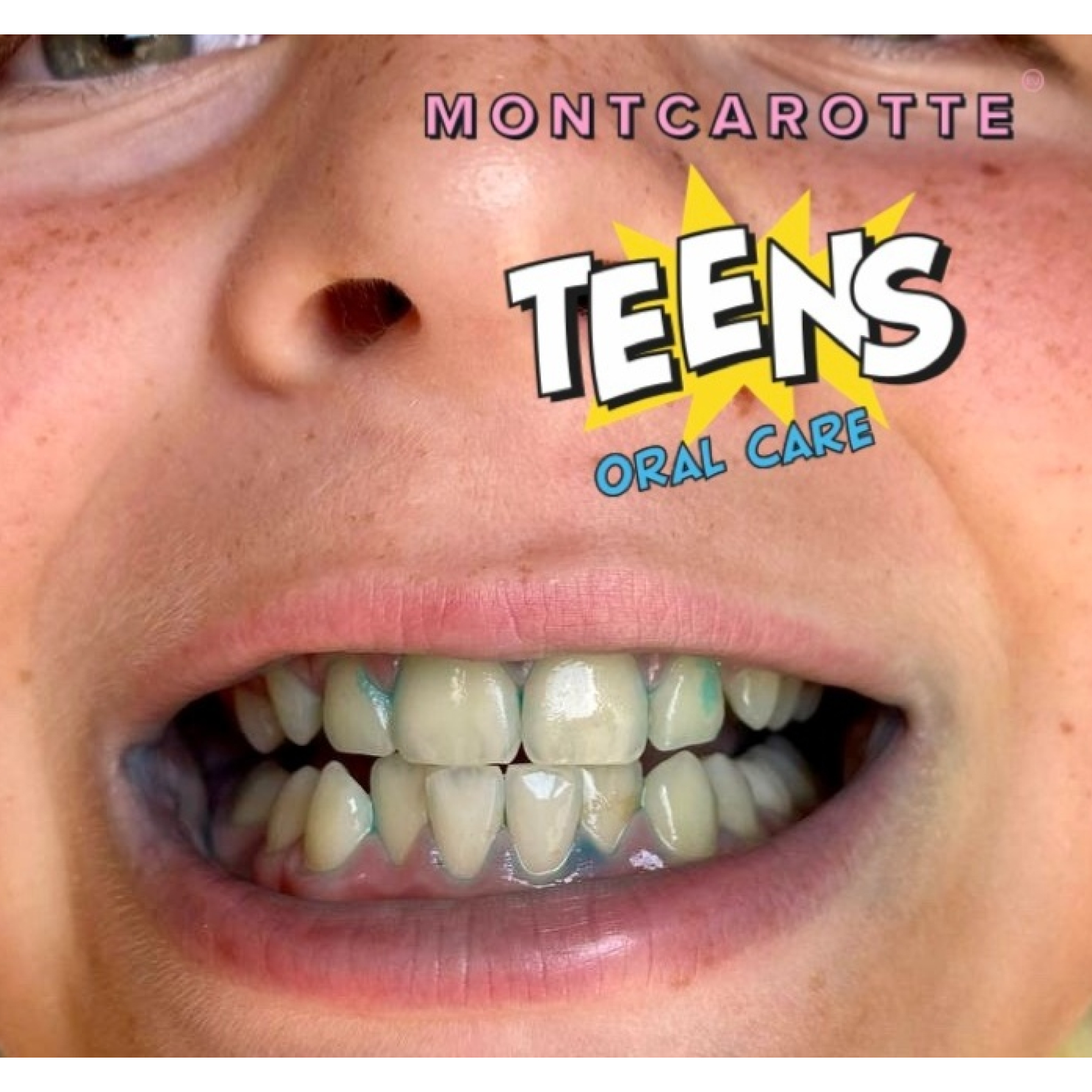 Зубная паста-маркер Montcarotte Grape Boom индикатор зубного налета - фото 15