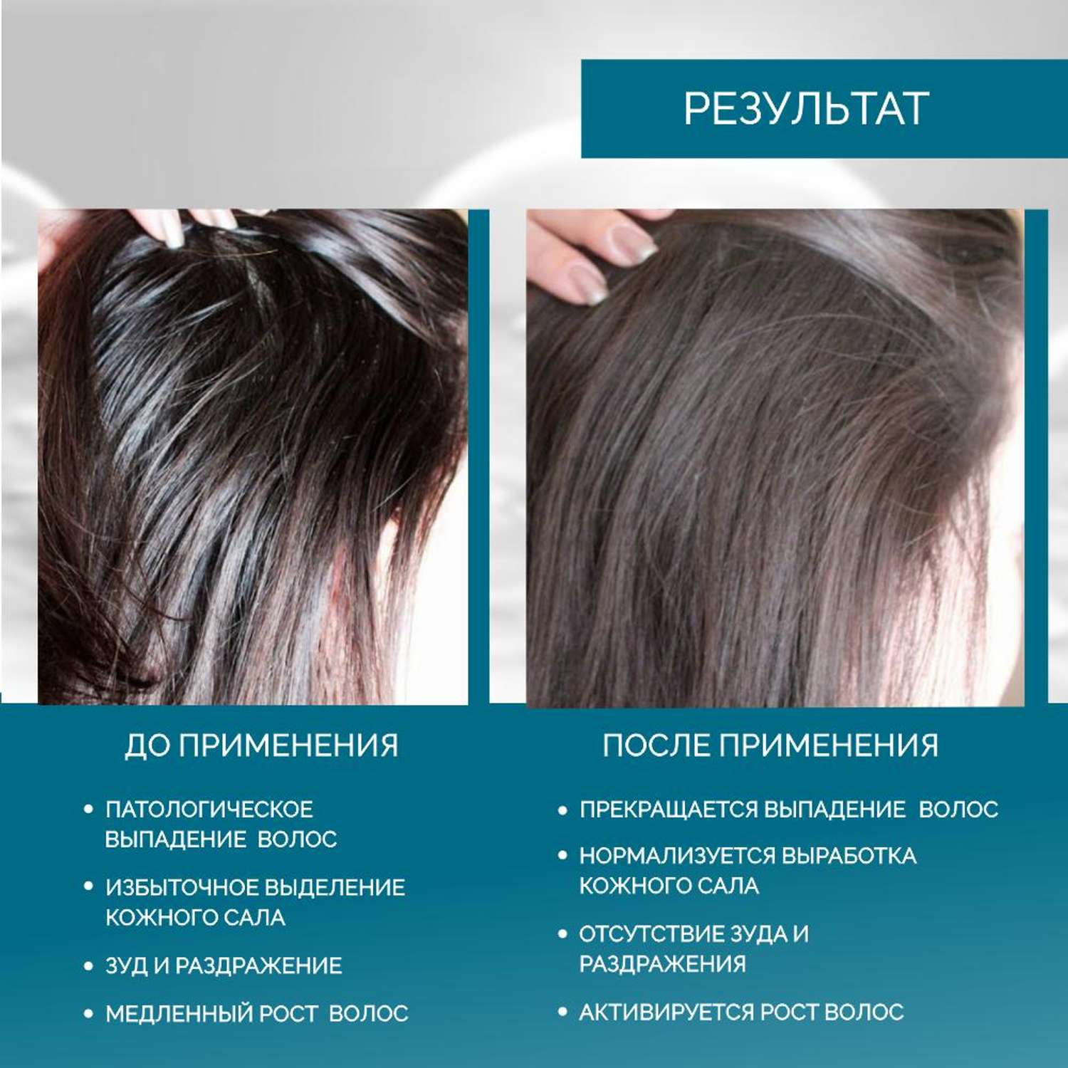 Лосьон Rinfoltil PRO Спрей для волос от выпадения для жирной кожи головы 100 мл - фото 2