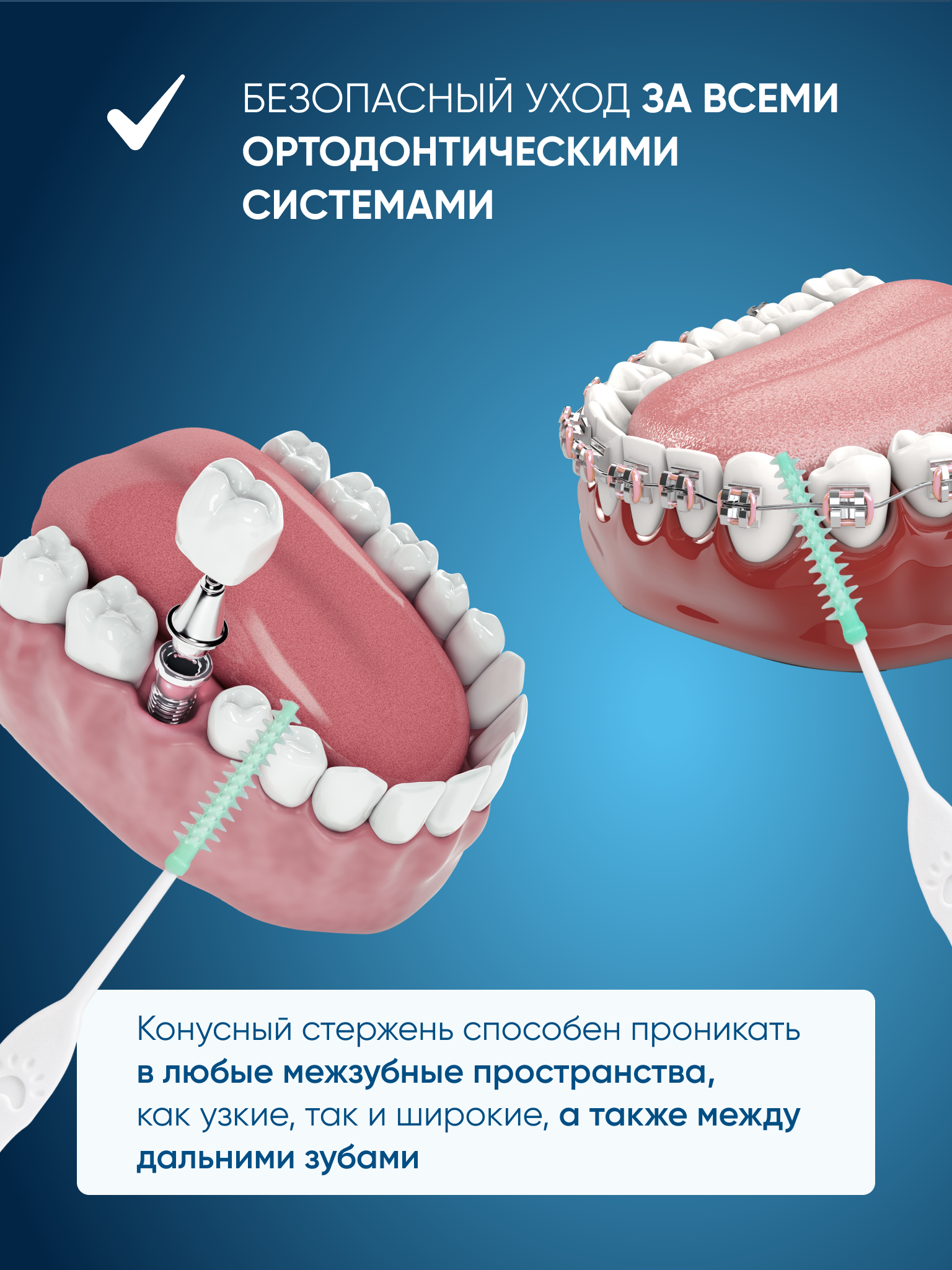 Межзубные ёршики-зубочистки PECHAM Dental Stick РС-602 - фото 3