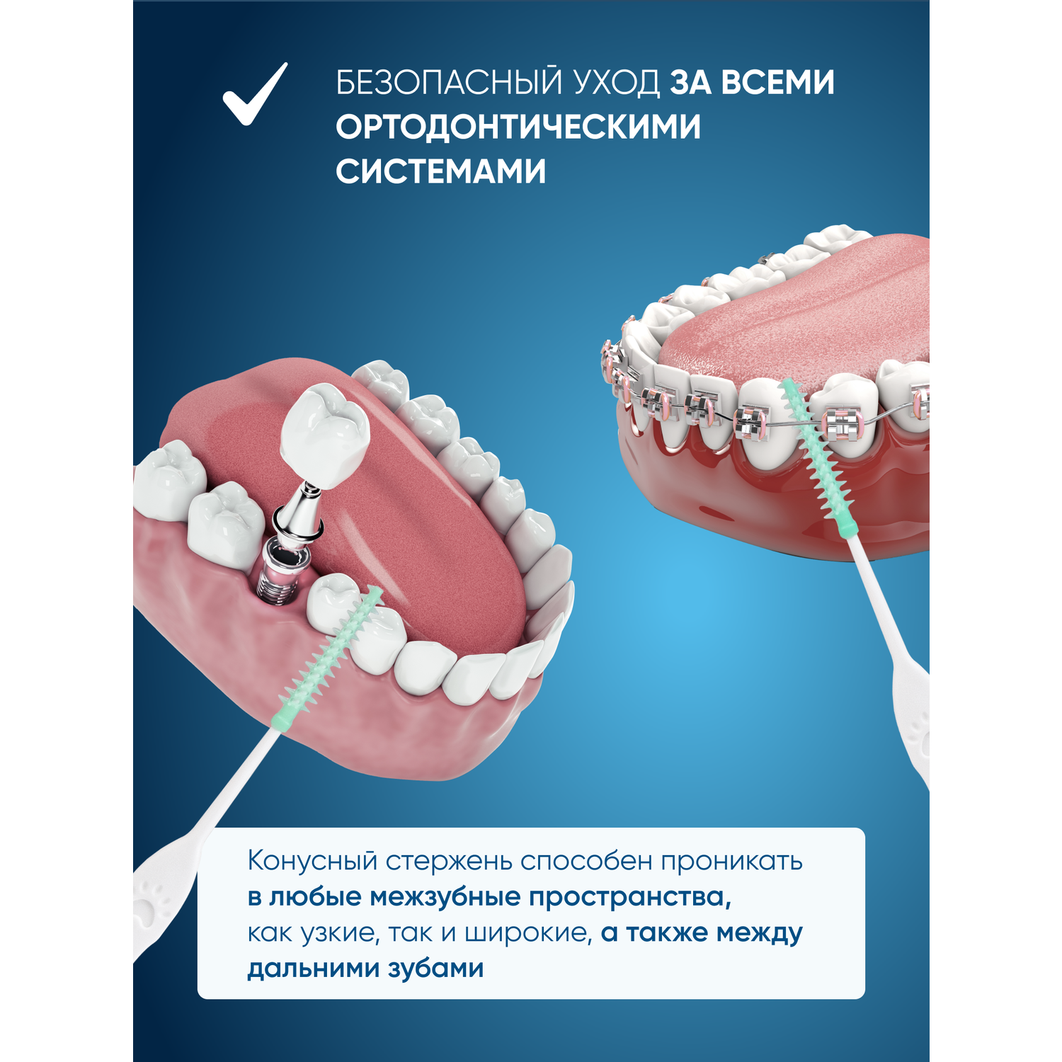 Межзубные ёршики-зубочистки PECHAM Dental Stick РС-602 - фото 3