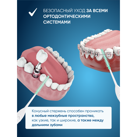 Межзубные ёршики-зубочистки PECHAM Dental Stick РС-602