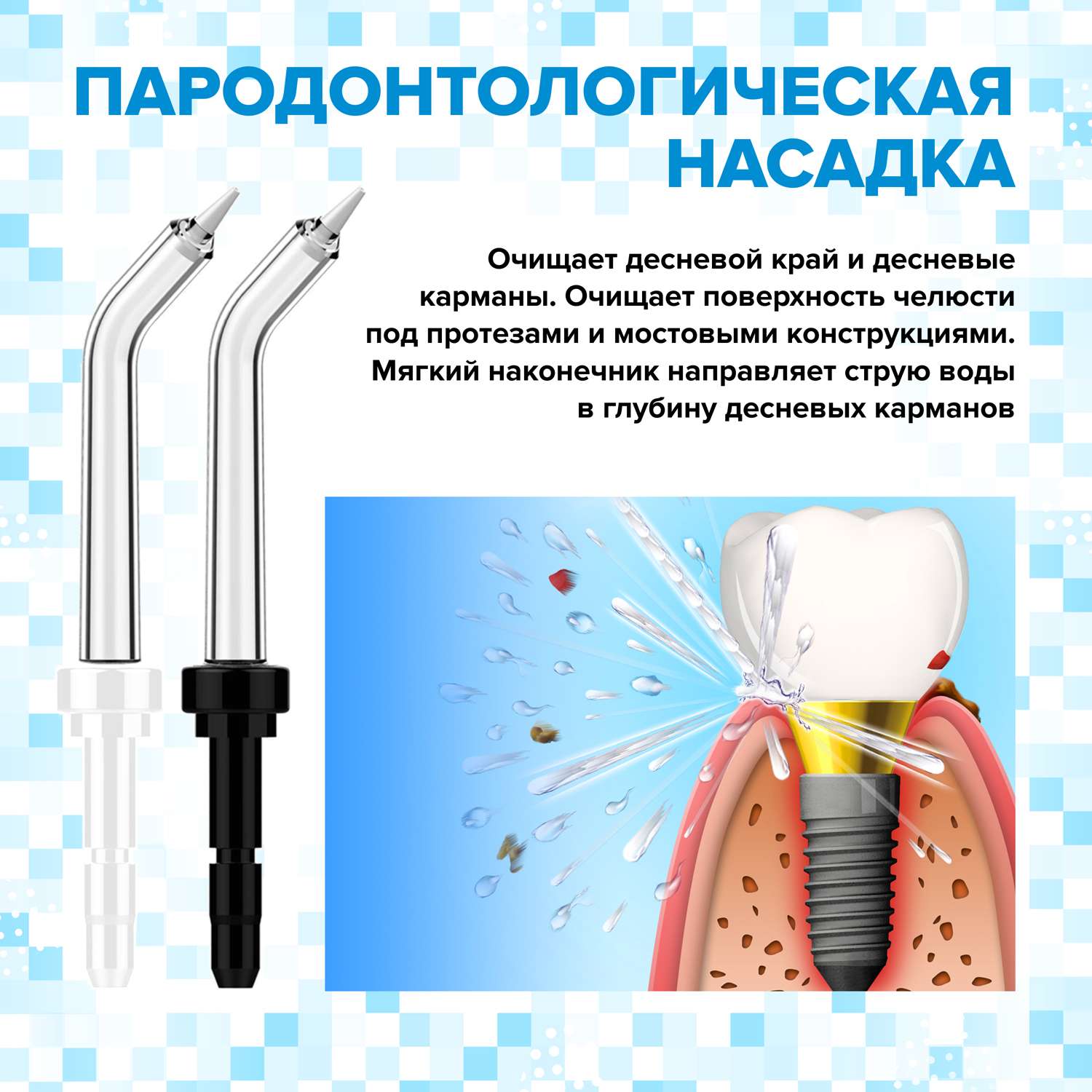 Ирригатор при пародонтозе. Пародонтологическая насадка для ирригатора. Revyline насадки Тип а, пародонталогические (2 шт). Waterpik ирригатор пародонтологическая насадка. Revyline пародонтологическая насадка.