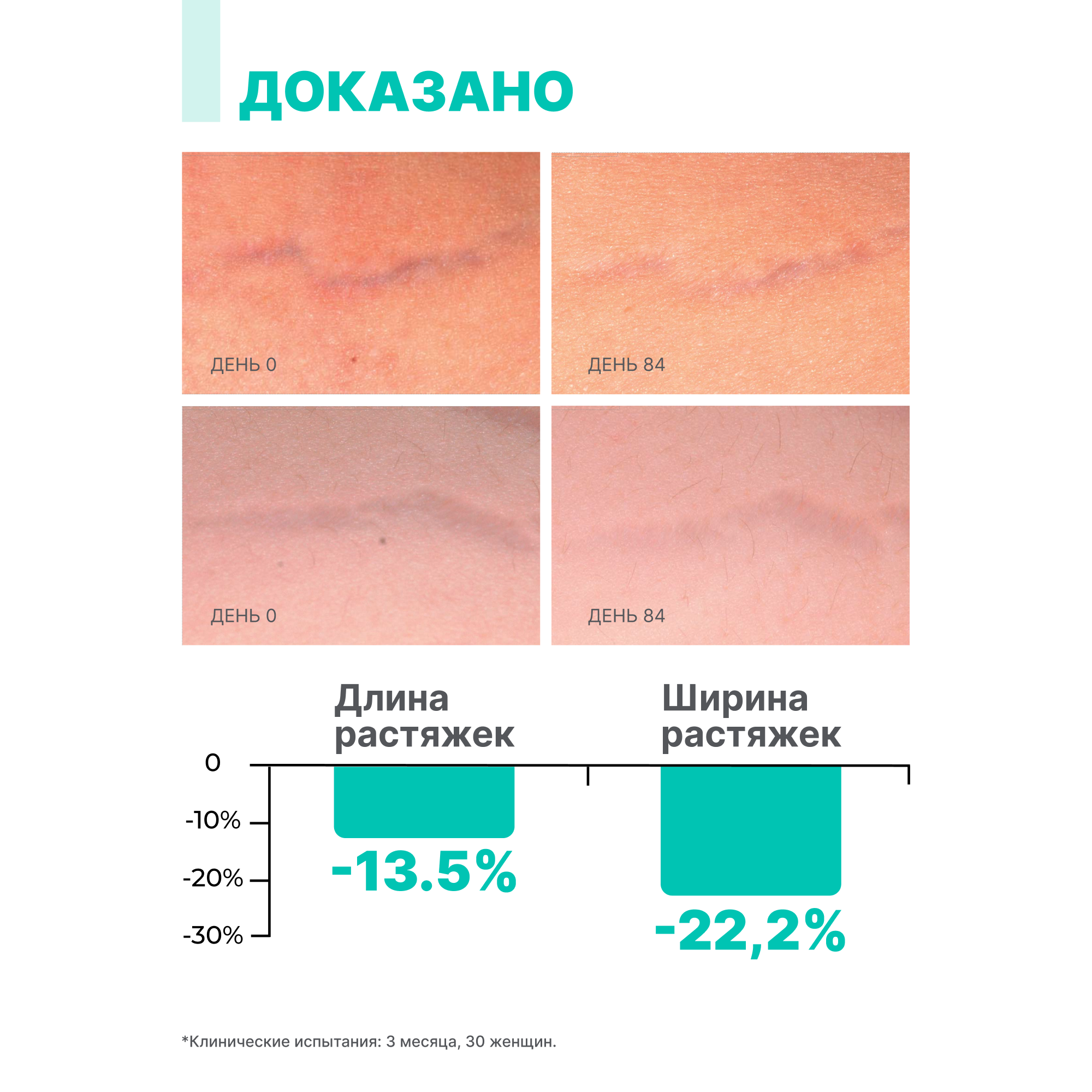 Крем против растяжек Лошадиная сила ультра интенсивный во время беременности и диет профилактика растяжек 150 мл - фото 5