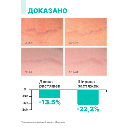 Крем против растяжек Лошадиная сила ультра интенсивный во время беременности и диет профилактика растяжек 150 мл