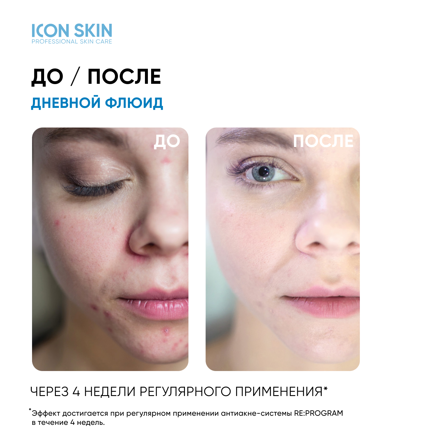 Крем ICON SKIN дневной matte and care 30 мл - фото 5