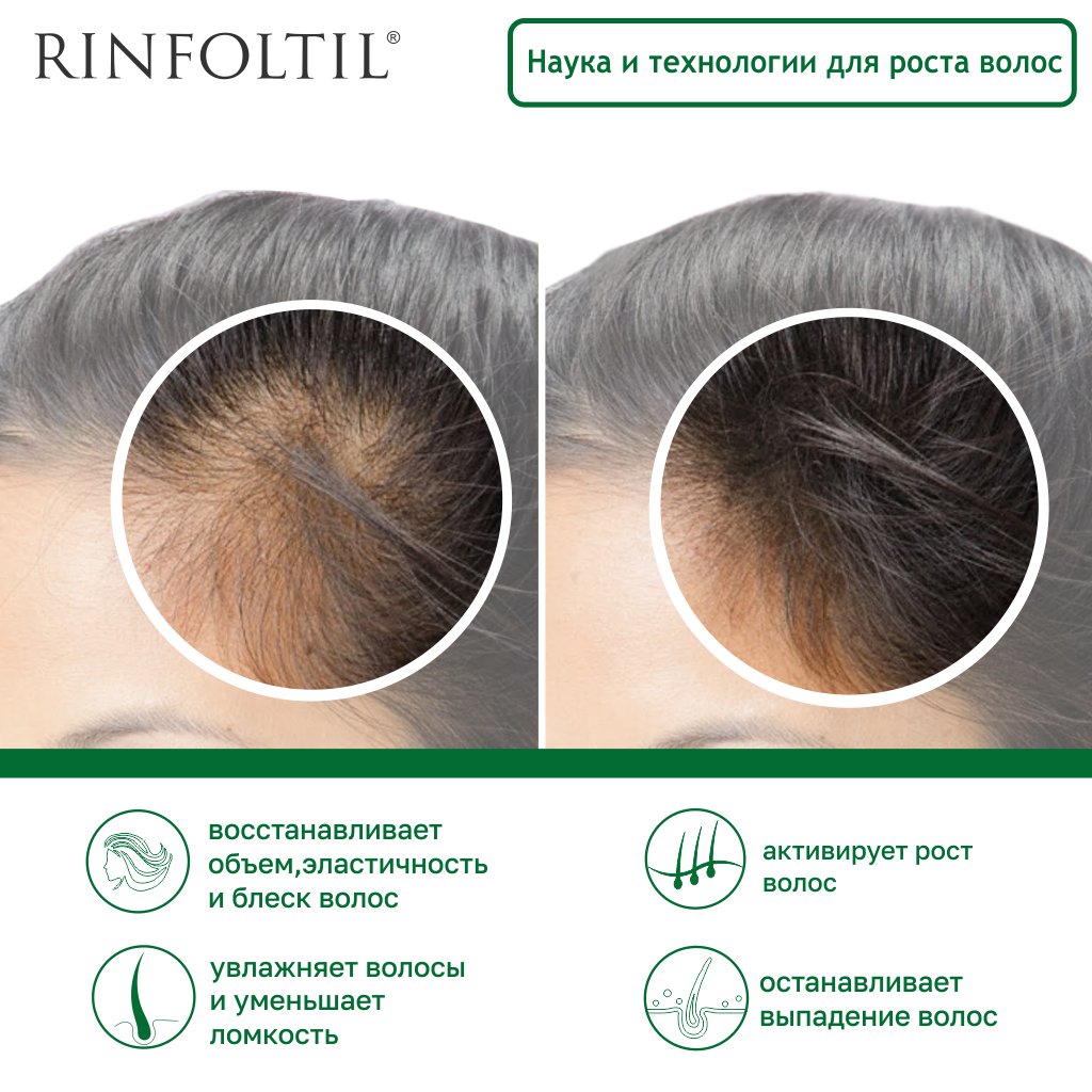 Сыворотка Ринфолтил Липосомальная против выпадения волос Для интенсивного роста - фото 3
