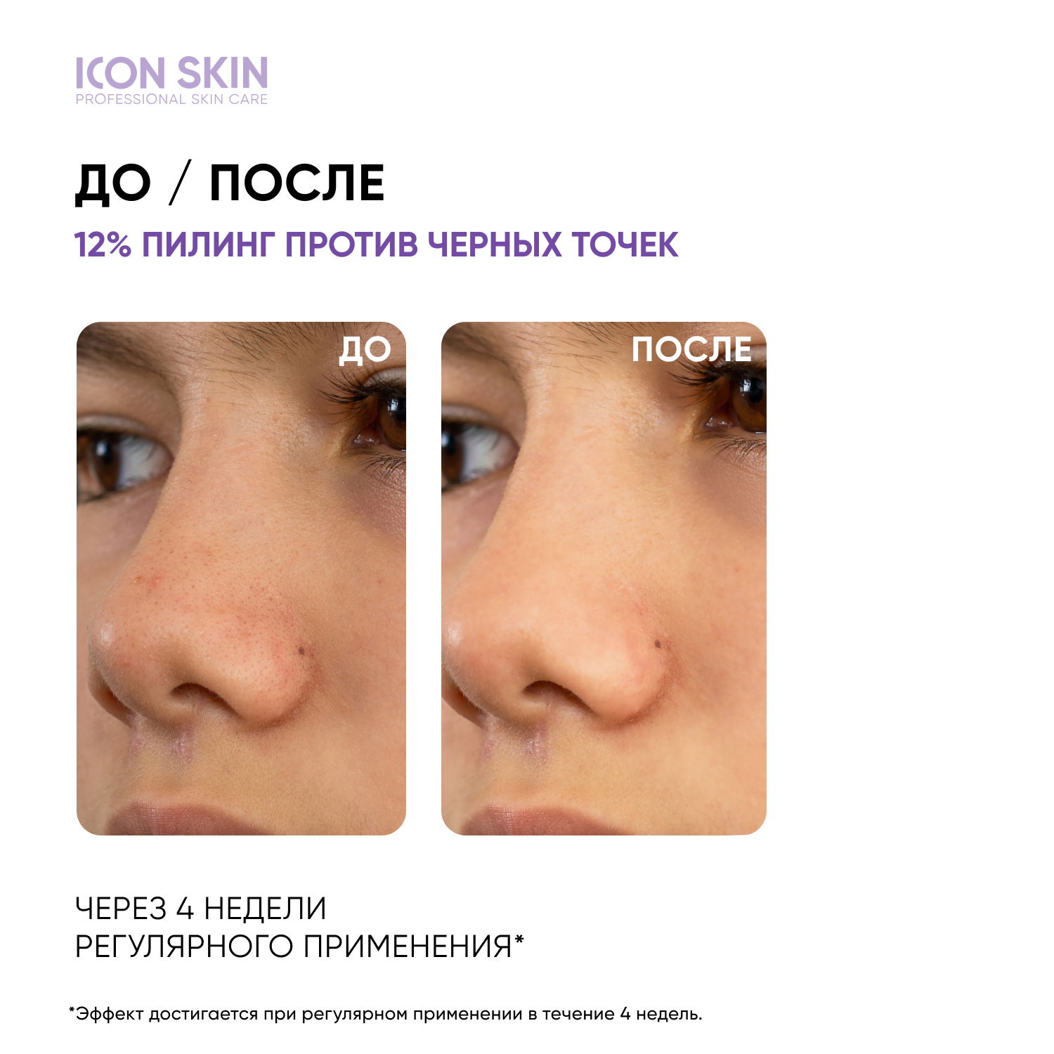 Пилинг ICON SKIN aha+bha 12% 30 мл - фото 2