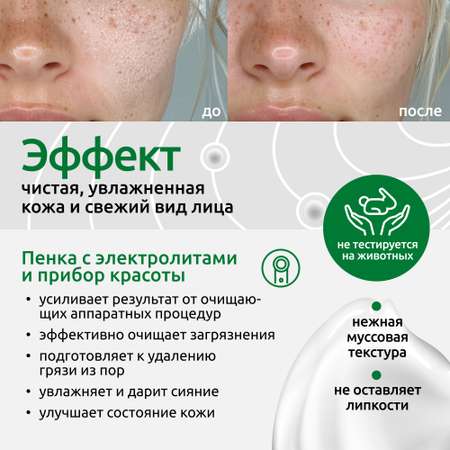 Пенка-мусс очищающая ReadySkin Care Ionica с электролитами для всех типов кожи