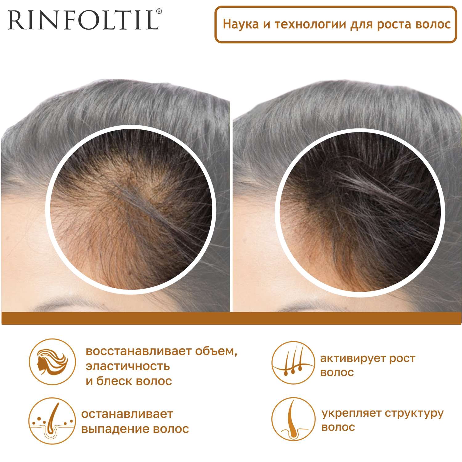 Сыворотка Rinfoltil Липосомальная против выпадения волос. При любом типе выпадения - фото 4