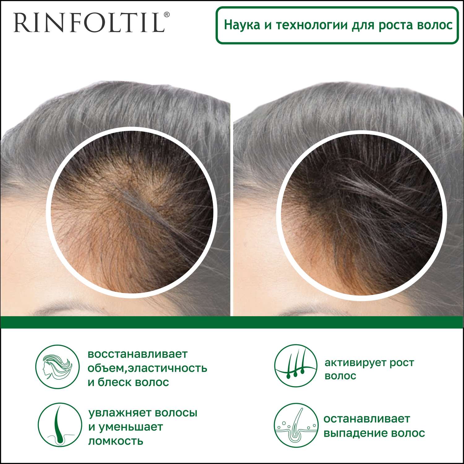 Сыворотка Rinfoltil Липосомальная против выпадения волос. Для интенсивного роста - фото 4