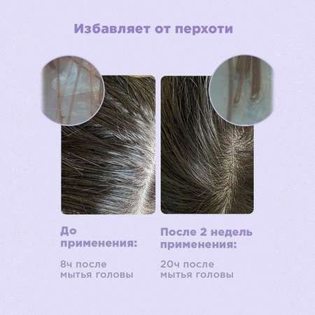 Софт-шампунь для волос Likato Professional Delikate уход для чувствительной кожи головы 250мл