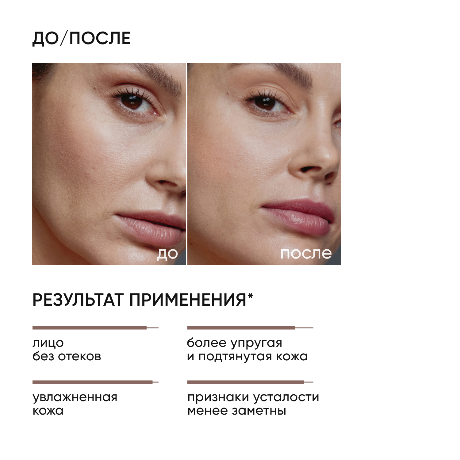 Тоник ICON SKIN лимфодренажный Skin Gym - фото 2