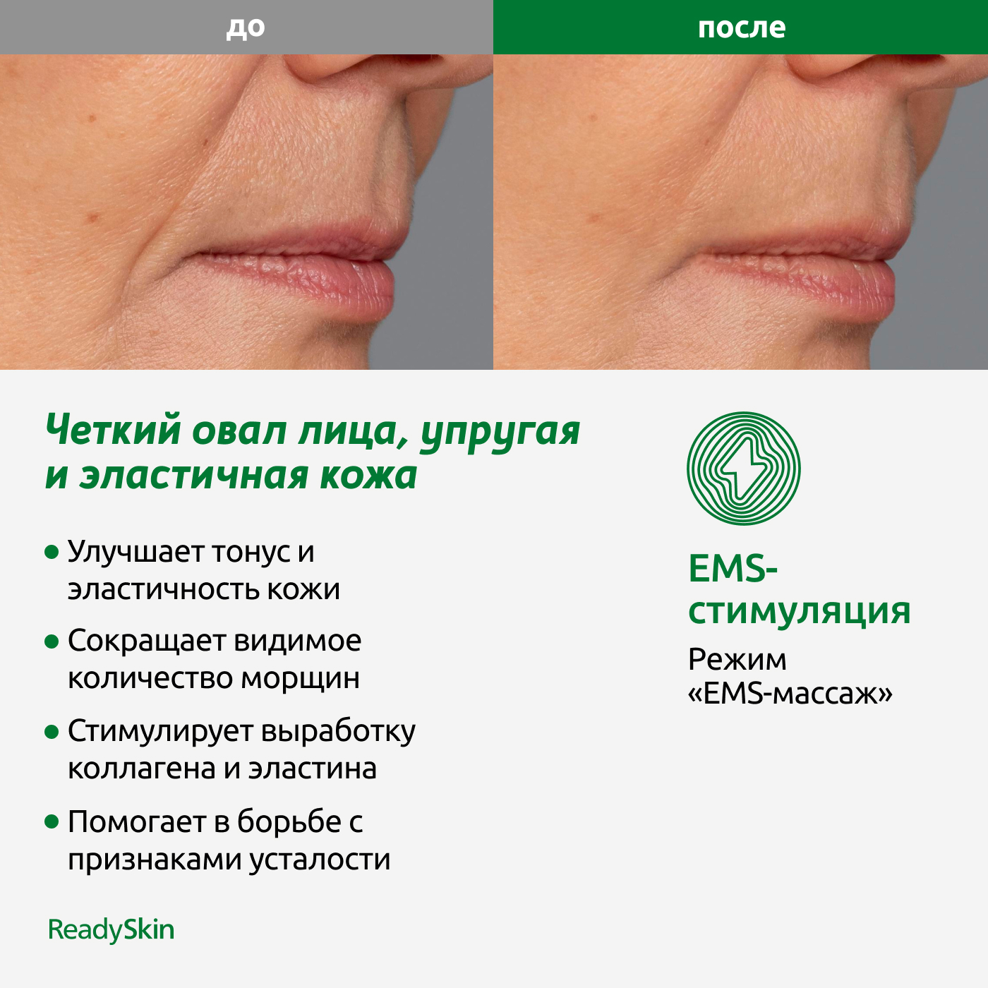 Прибор ReadySkin Octa для очищения и омоложения кожи купить по цене 14590 ₽  в интернет-магазине Детский мир