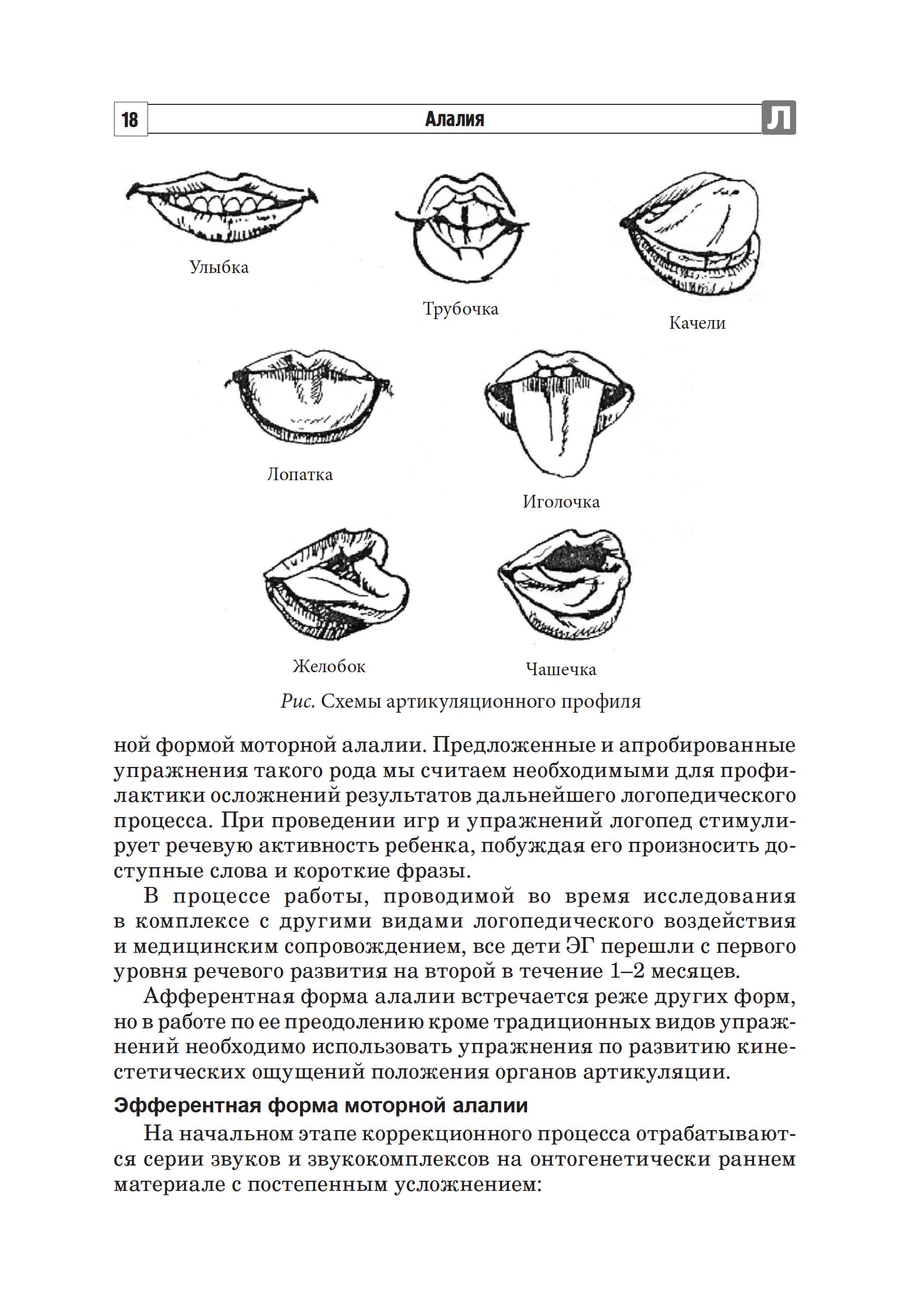 Книга ТЦ Сфера Алалия. Коррекционно-логопедическая работа с детьми с алалией. - фото 3