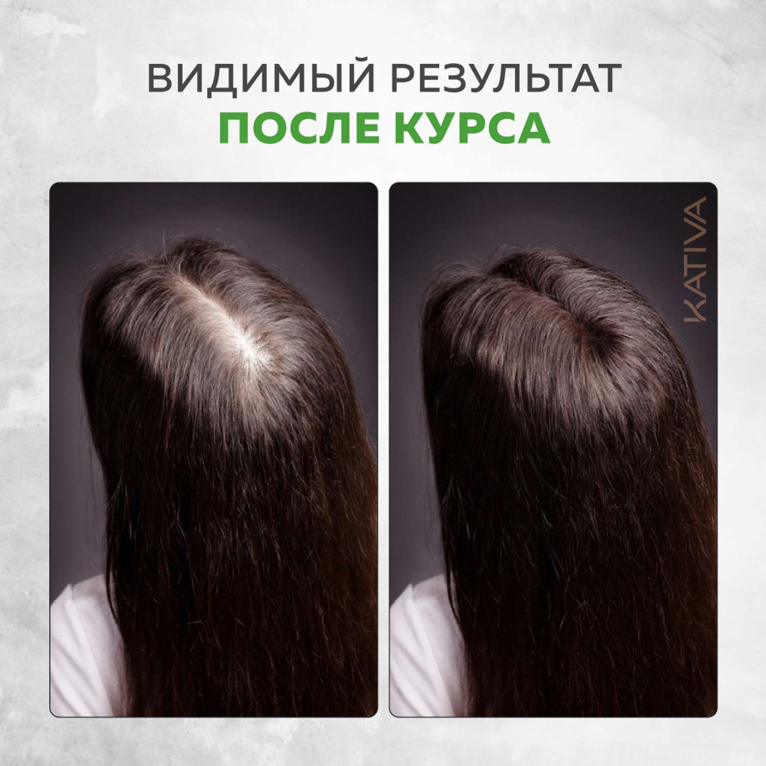 Шампунь Kativa против выпадения волос с биотином Biotina 250 мл - фото 6