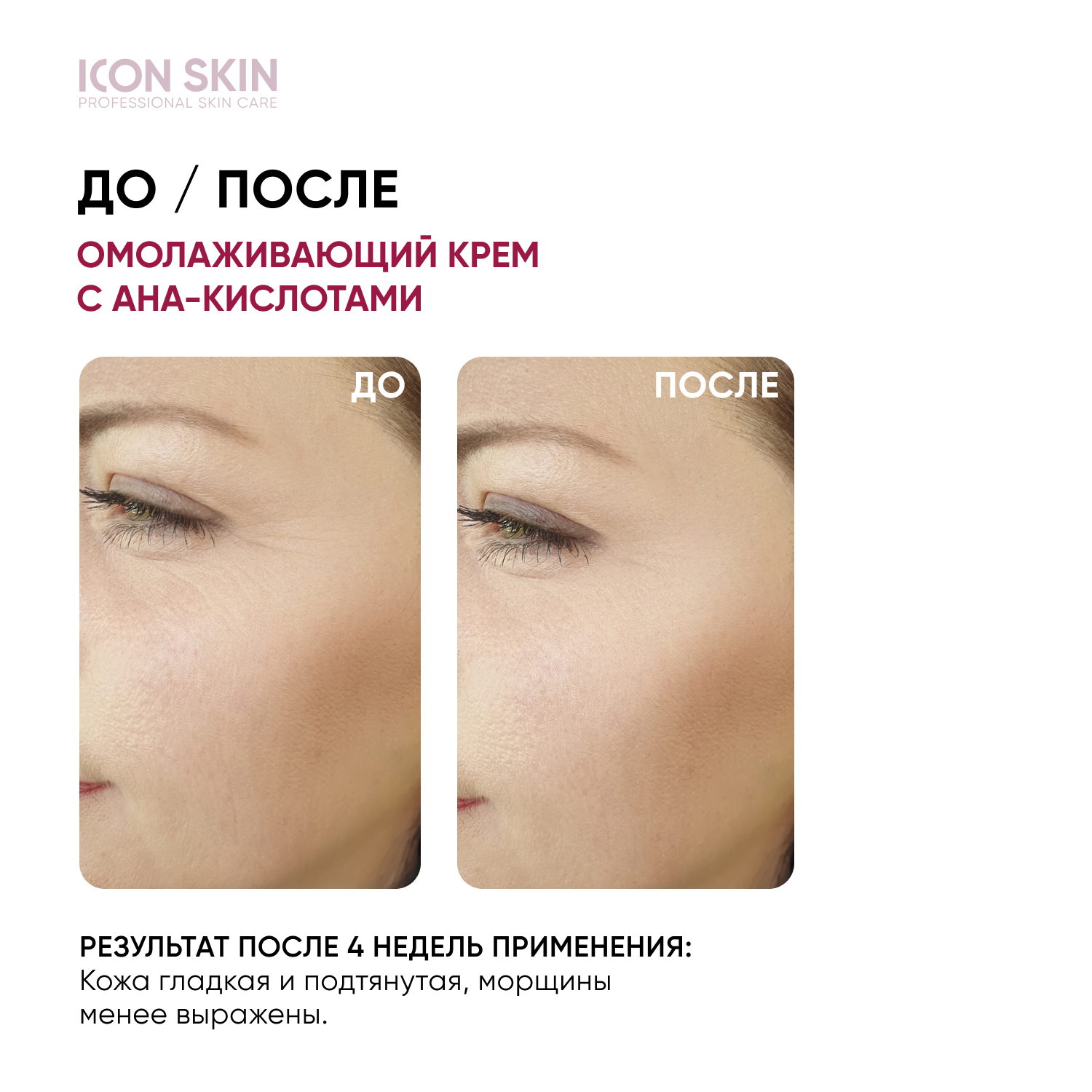 Крем ICON SKIN омолаживающий ночной soft peel 30 мл - фото 2