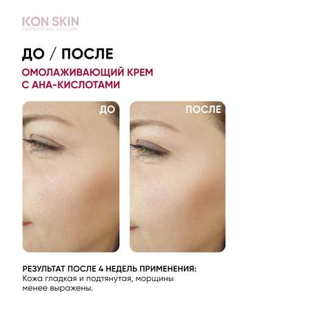 Крем ICON SKIN омолаживающий ночной soft peel 30 мл