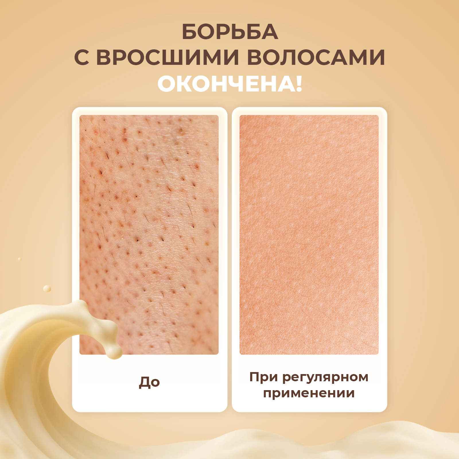 Крем после депиляции YesMix от вросших волос и раздражения, 200 мл - фото 2