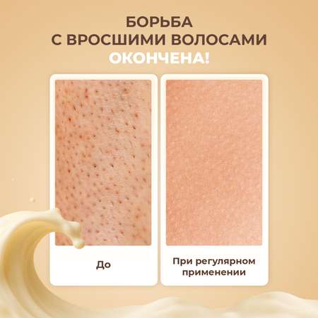 Крем после депиляции YesMix от вросших волос и раздражения, 200 мл