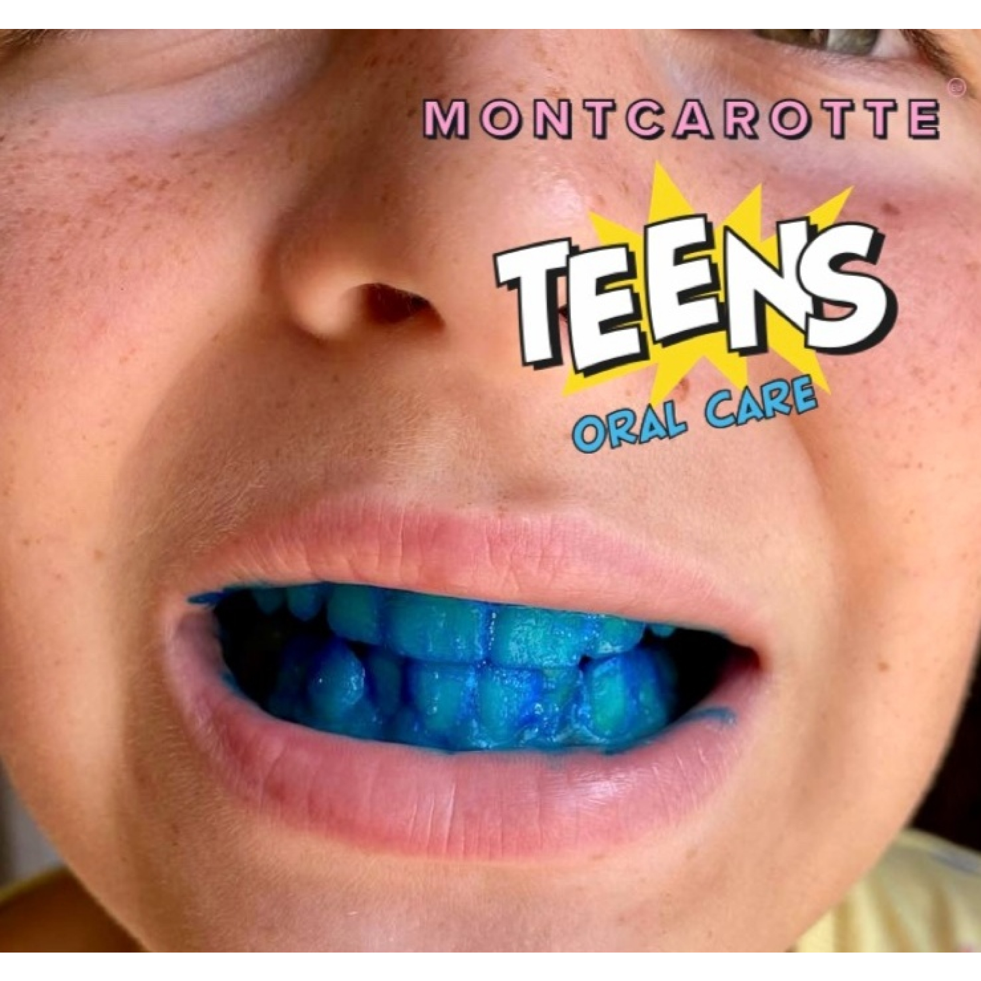 Зубная паста-маркер Montcarotte Grape Boom индикатор зубного налета - фото 14