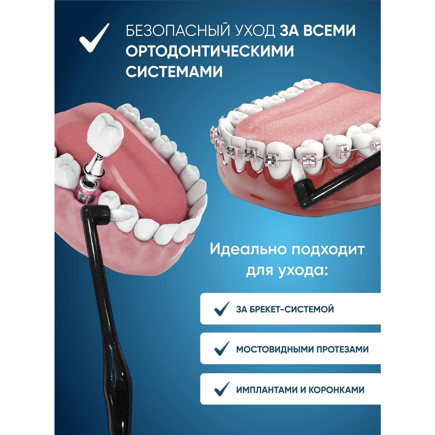 Монопучковая зубная щетка PECHAM Ortho РС-403 - фото 4