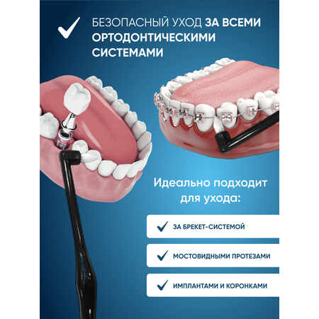Монопучковая зубная щетка PECHAM Ortho РС-403