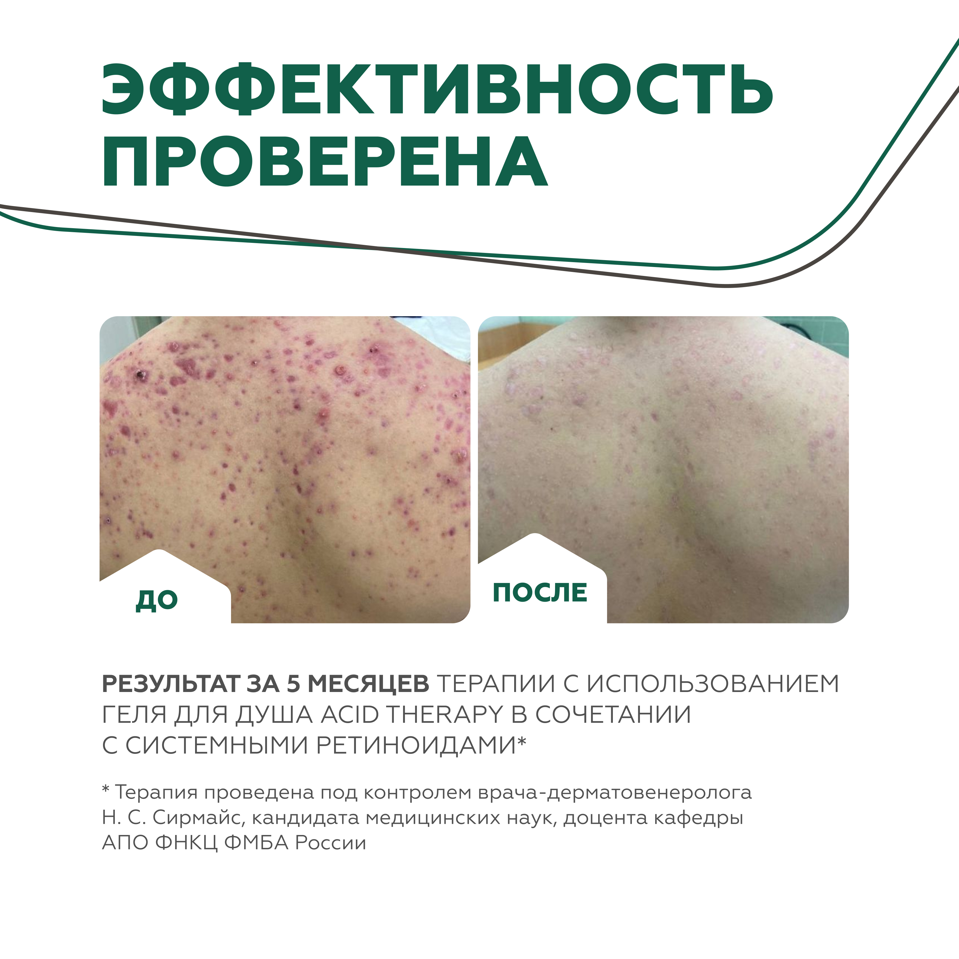 Гель для душа GELTEK Acid therapy с кислотами + миниатюра - фото 5