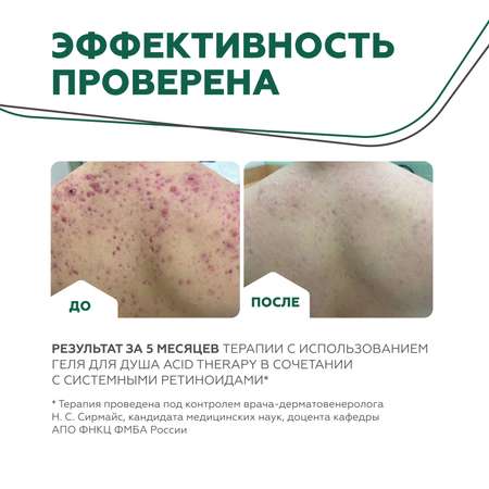 Гель для душа GELTEK Acid therapy с кислотами + миниатюра