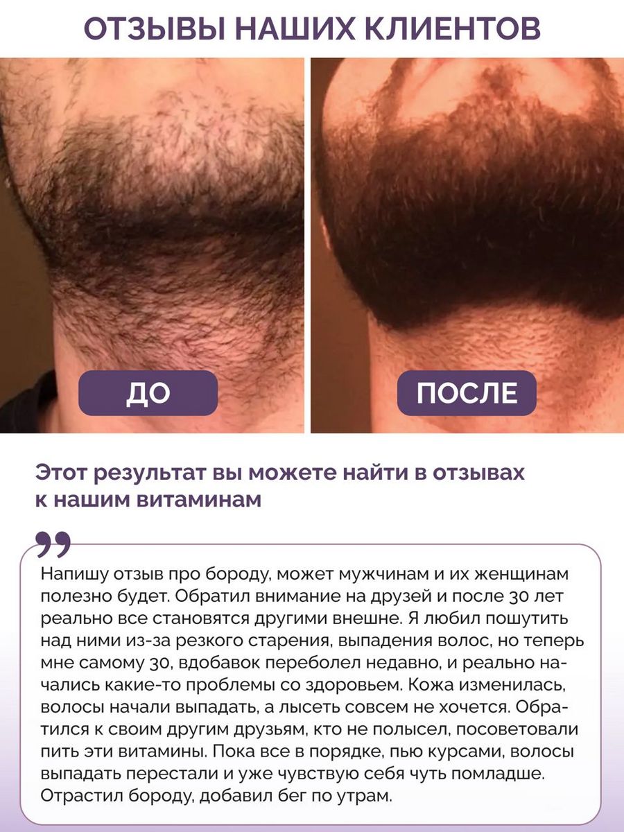 Витамины для волос кожи ногтей BIOTTE hair nails skin витаминно-минеральный комплекс БАД 180 капсул - фото 2