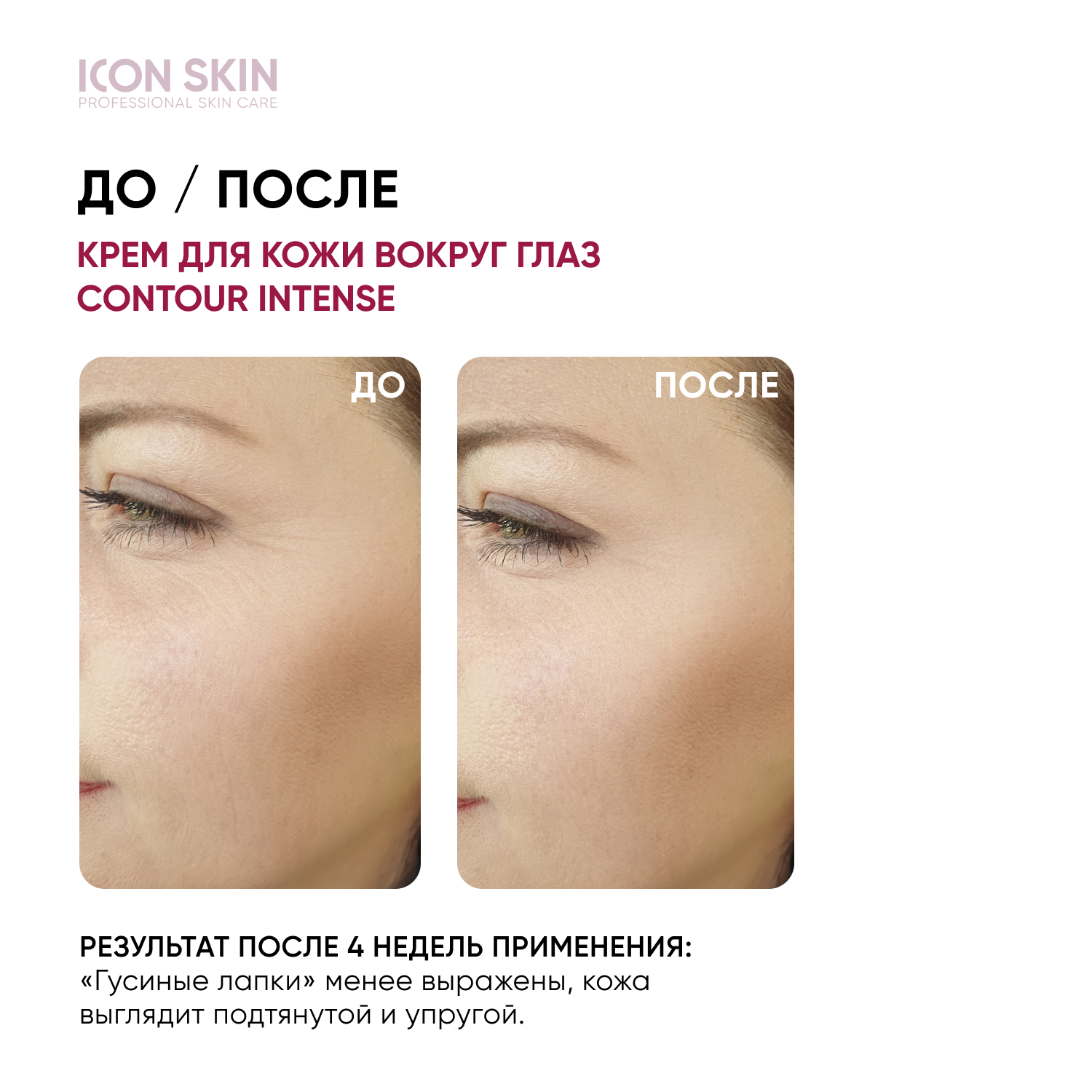 Крем для кожи вокруг глаз ICON SKIN омолаживающий CONTOUR INTENSE - фото 2