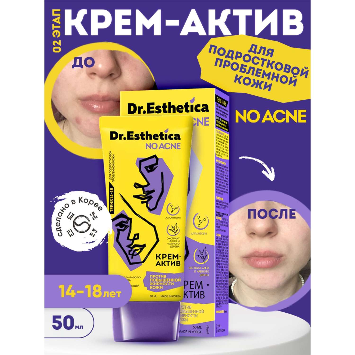 Крем-актив Dr. Esthetica против прыщей 50 мл - фото 4