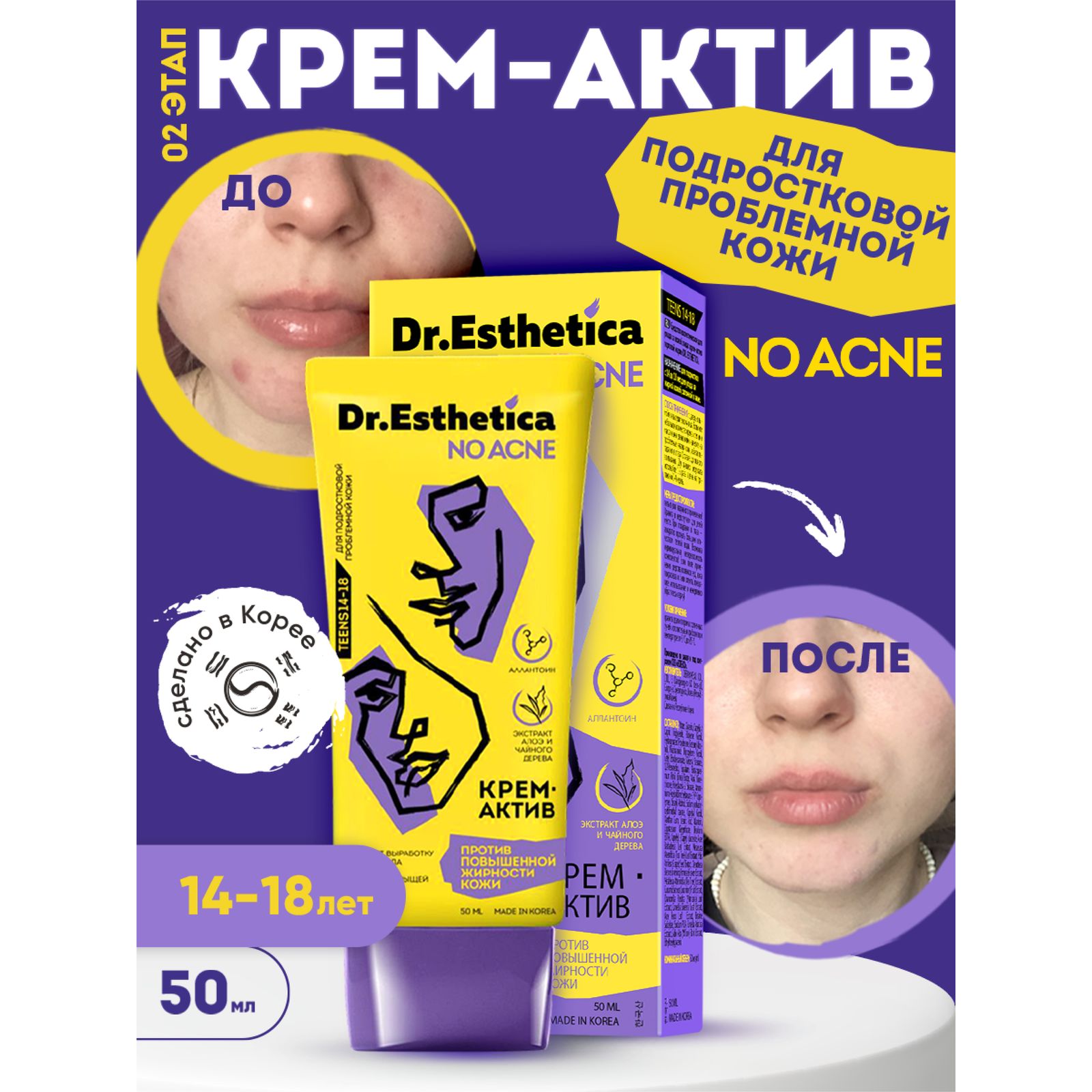 Крем-актив Dr. Esthetica против прыщей 50 мл - фото 4