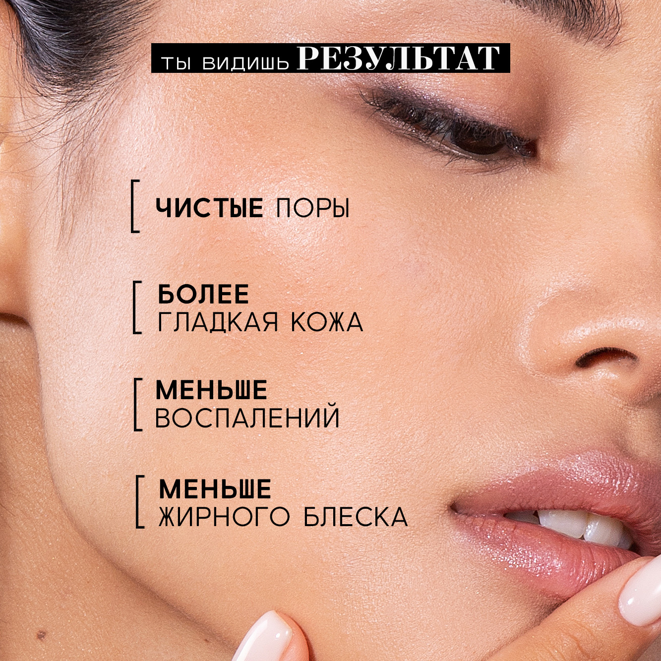 Пилинг для лица BEAUTIFIC Acne Killa с салициловой кислотой 18% матирующий от постакне 30 мл - фото 5