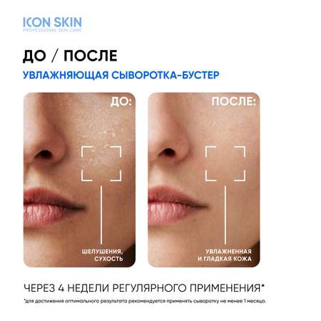 Увлажняющая сыворотка ICON SKIN Feel the Moist с гиалуроновой кислотой