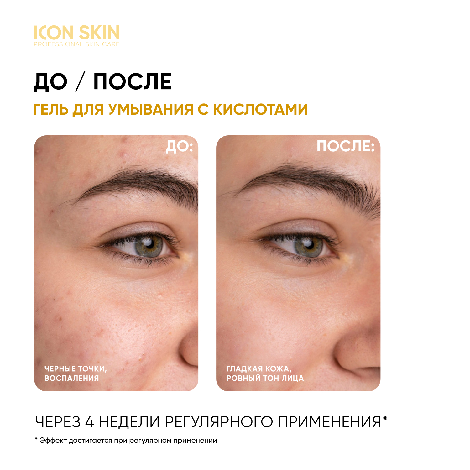 Icon Skin, Очищающий гель для умывания с кислотами Soft Renew, 150 мл