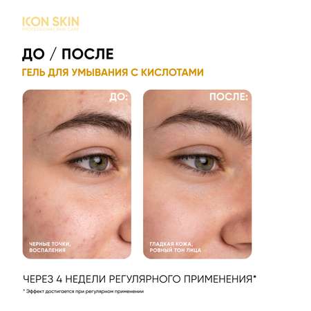 Гель для умывания ICON SKIN 5% AHA+PHA+BHA кислот для всех типов кожи