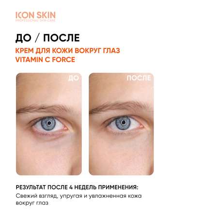 Крем для кожи вокруг глаз ICON SKIN от темных кругов и морщин с витамином С и пептидом
