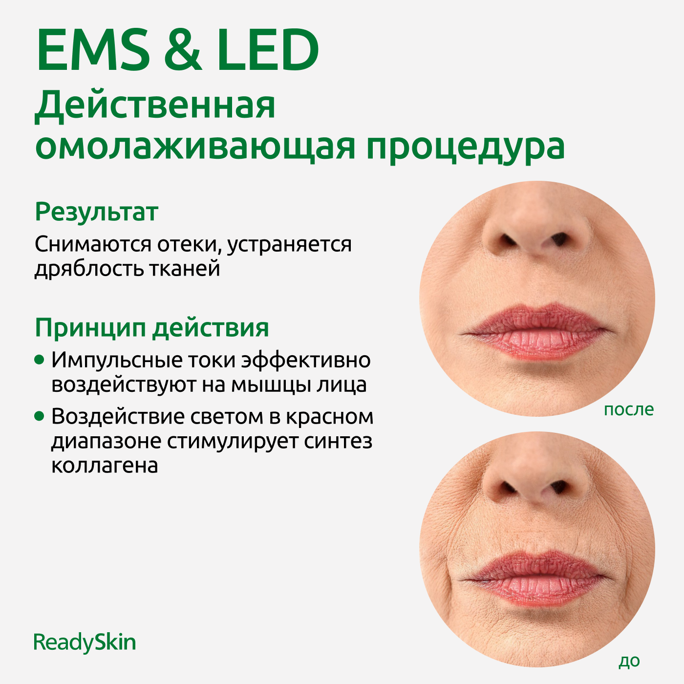 Аппарат для омоложения ReadySkin Eva - фото 7