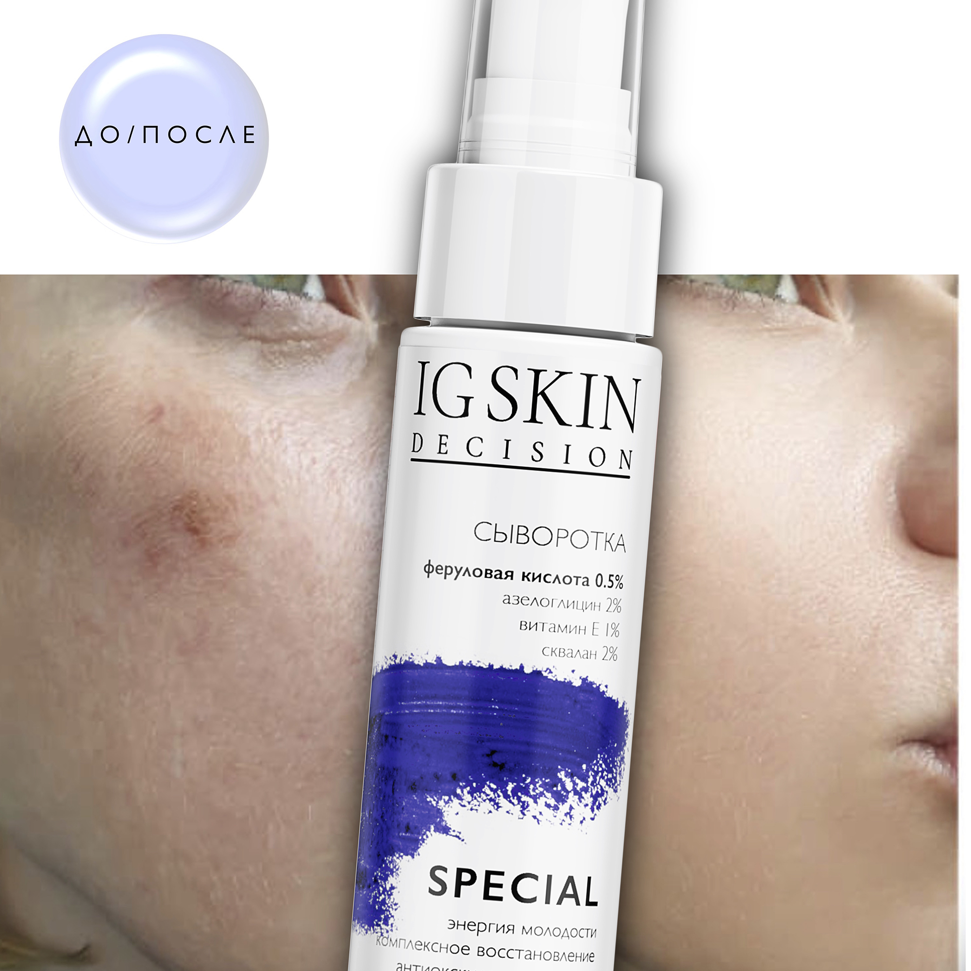 Сыворотка для лица IG SKIN Decision антиэйдж и комплексное восстановление с феруловой кислотой 0.5% и азелоглицином - фото 5