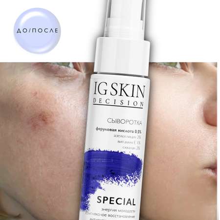 Сыворотка для лица IG SKIN Decision антиэйдж и комплексное восстановление с феруловой кислотой 0.5% и азелоглицином