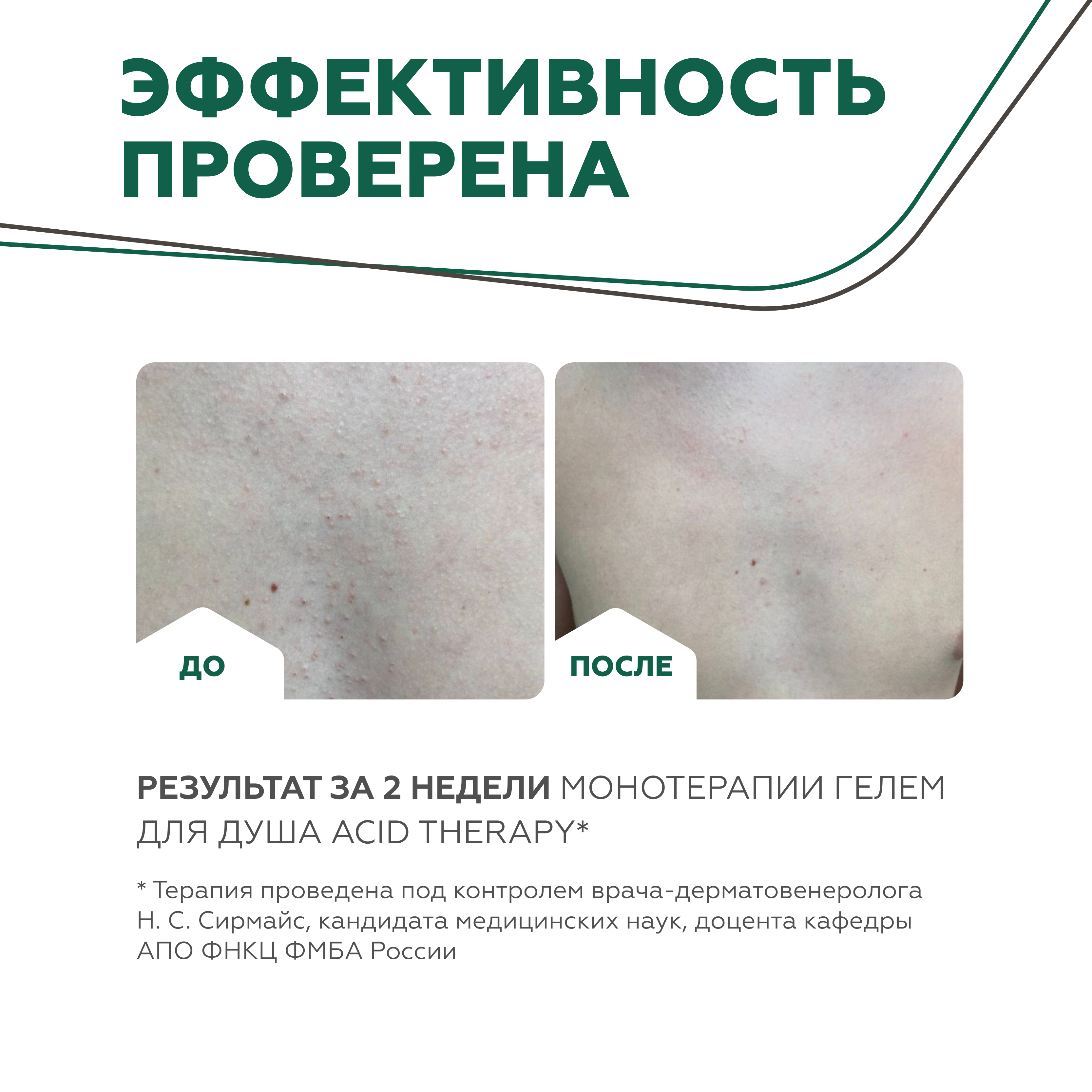 Гель для душа GELTEK Acid therapy с кислотами 240 мл - фото 6