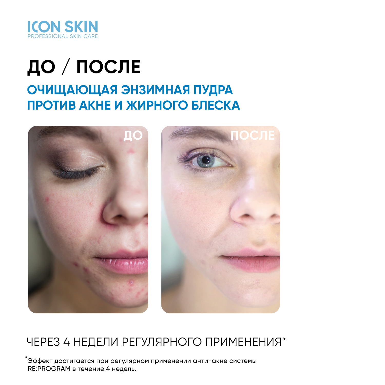 Энзимная пудра ICON SKIN очищающая для умывания - фото 3