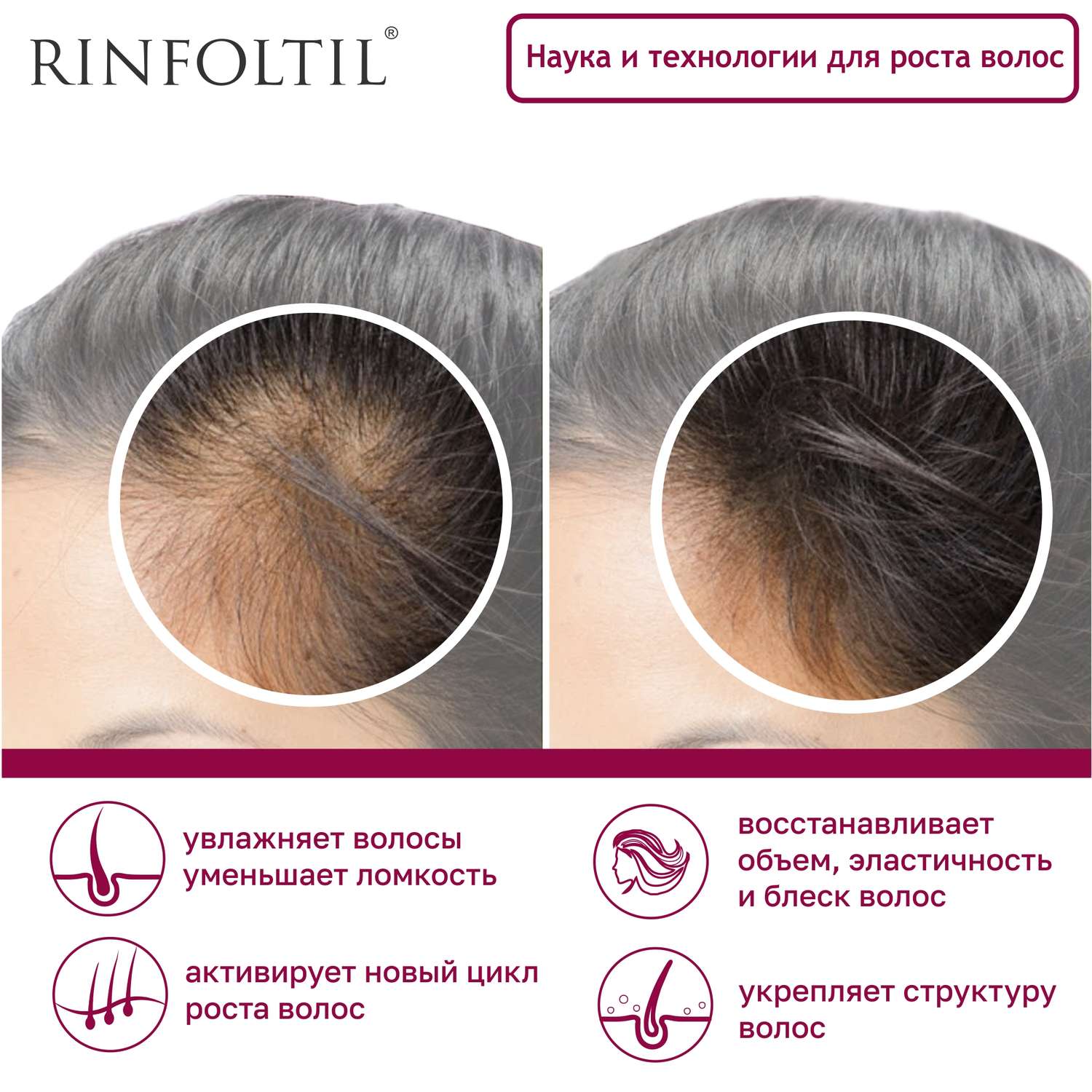 Сыворотка Rinfoltil Липосомальная против выпадения волос. Для ослабленных и истонченных - фото 4
