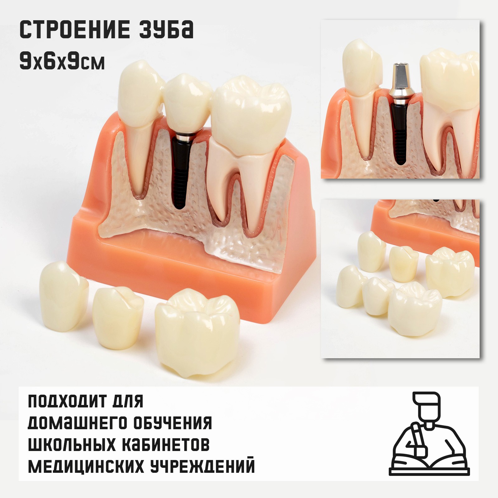 Макет Sima-Land «Строение зуба» 9*6*9см купить по цене 4678 ₽ в  интернет-магазине Детский мир