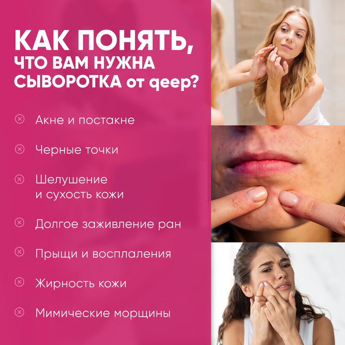 Сыворотка qeep отбеливающая для лица от прыщей и угрей - фото 5