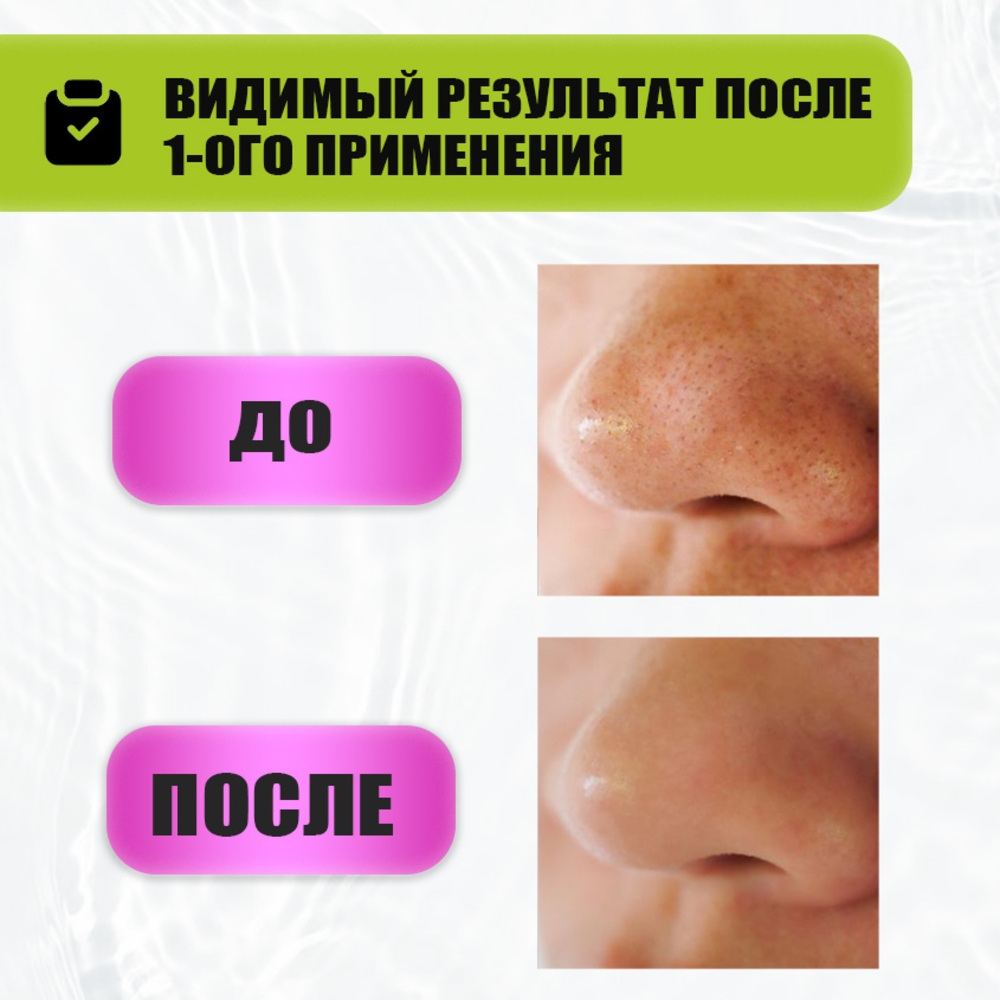 Содовый скраб для лица EDEN Stop Acne от прыщей 75 мл - фото 3