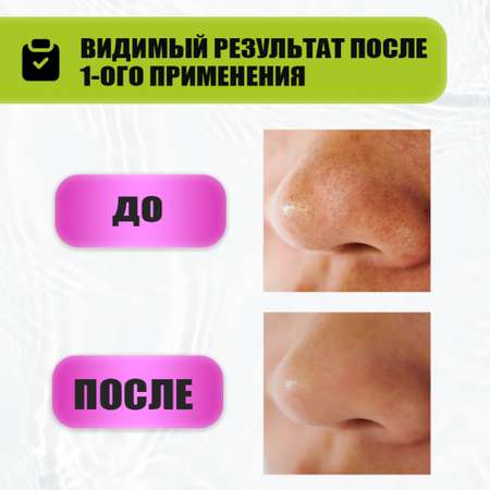 Содовый скраб для лица EDEN Stop Acne от прыщей 75 мл