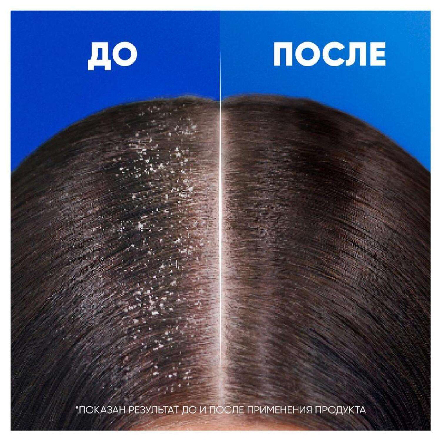 Шампунь и Бальзам-ополаскиватель Head and Shoulders против перхоти 2в1 Ментол 360мл - фото 6