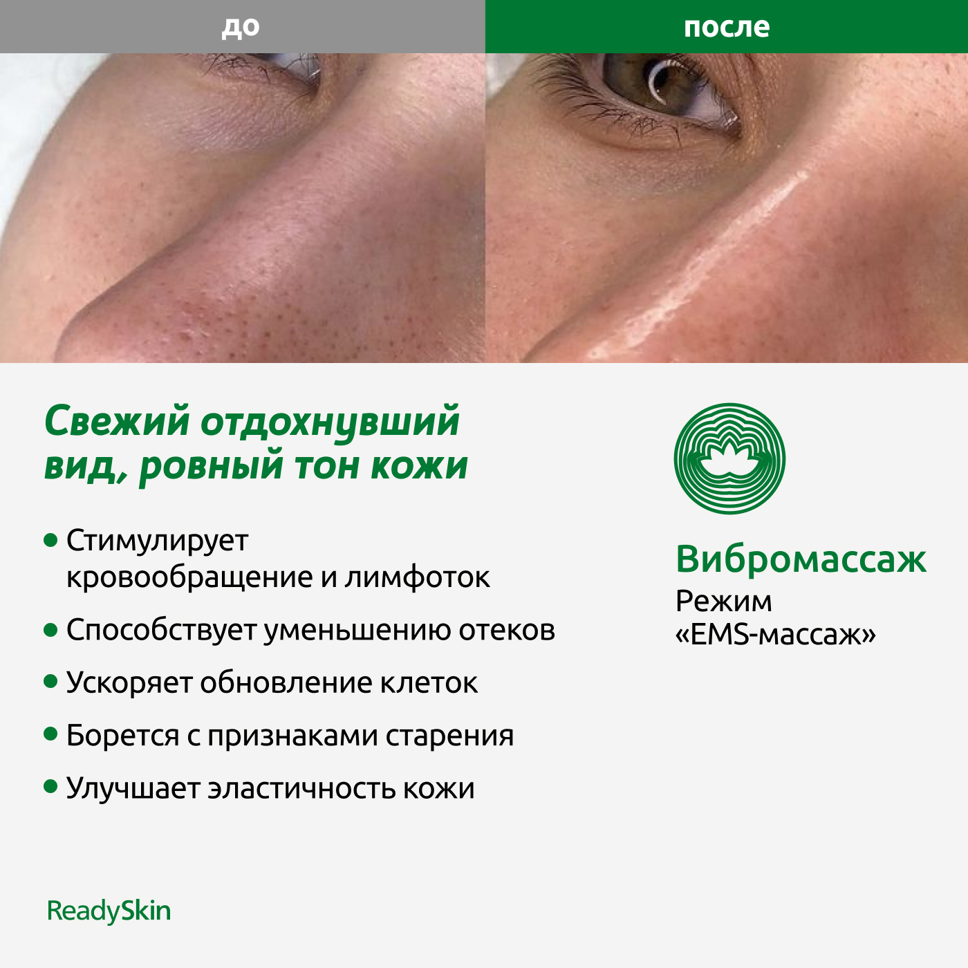 Прибор ReadySkin Octa для очищения и омоложения кожи - фото 10